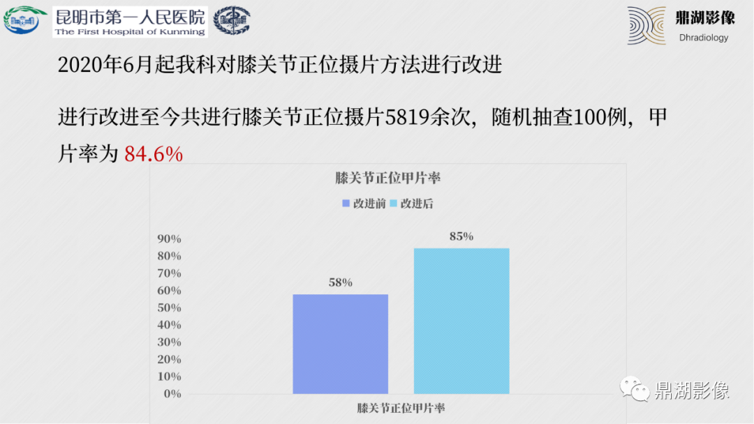 影像PPT - 【PPT】膝关节X线摄片技术改进-24