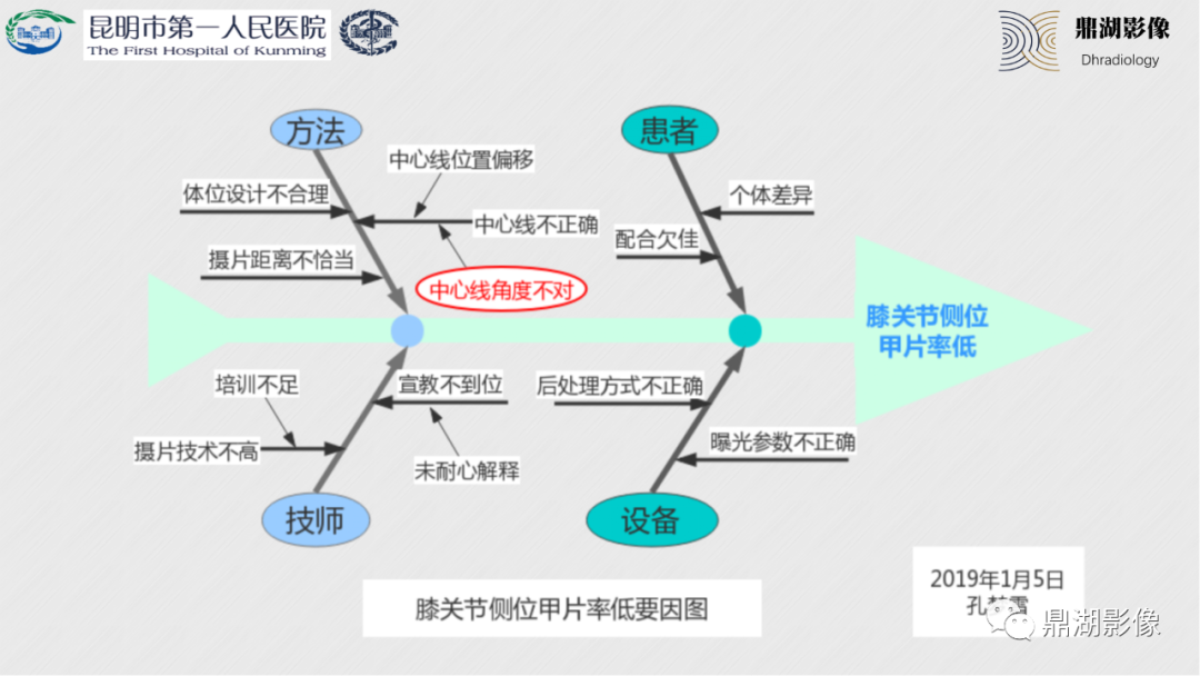影像PPT - 【PPT】膝关节X线摄片技术改进-31