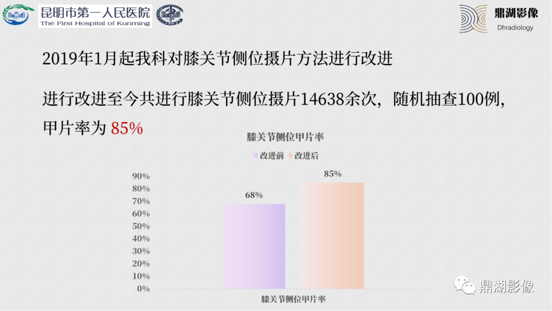 影像PPT - 【PPT】膝关节X线摄片技术改进-43