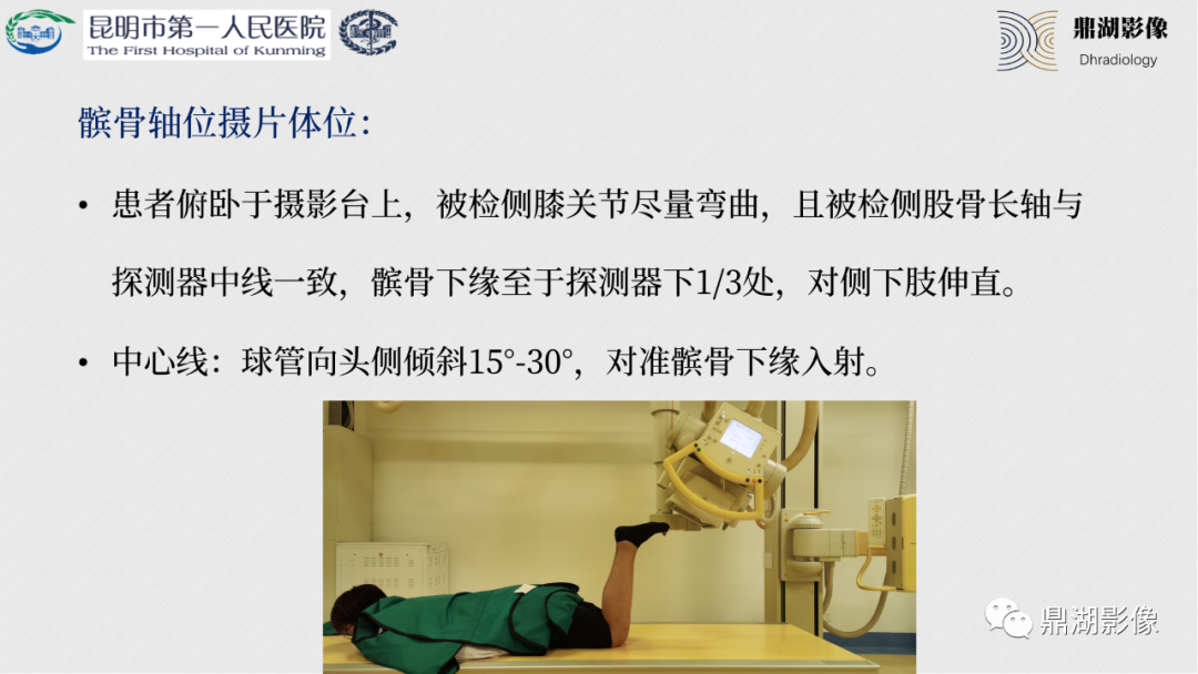 影像PPT - 【PPT】膝关节X线摄片技术改进-45