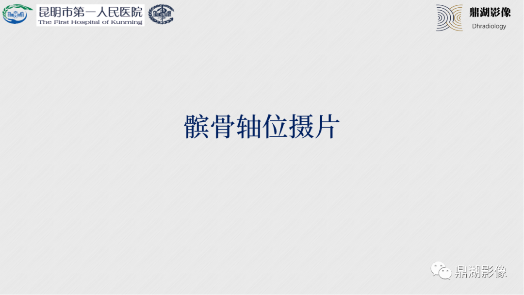 影像PPT - 【PPT】膝关节X线摄片技术改进-44