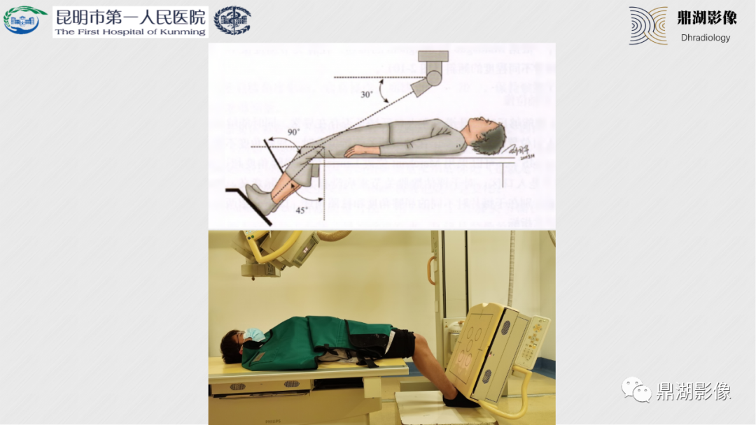 影像PPT - 【PPT】膝关节X线摄片技术改进-53