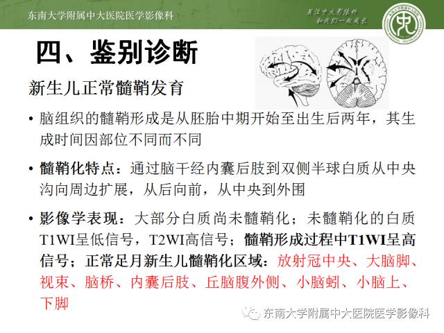 影像PPT - 【PPT】新生儿胆红素脑病-10 影像PPT - 【PPT】新生儿胆红素脑病-10