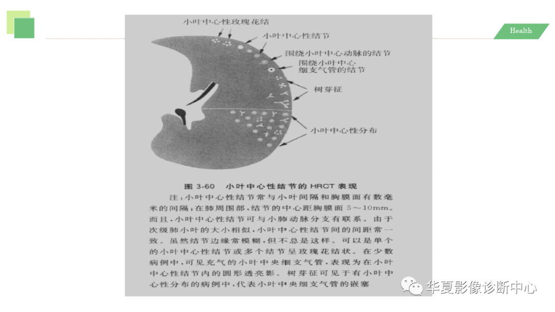 影像PPT - 【PPT】活动性肺结核抗结核治疗疗效的影像学评价-13