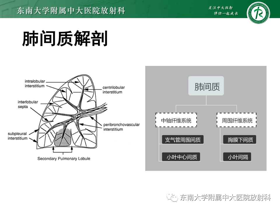影像PPT - 【PPT】肺淋巴管周围结节-5
