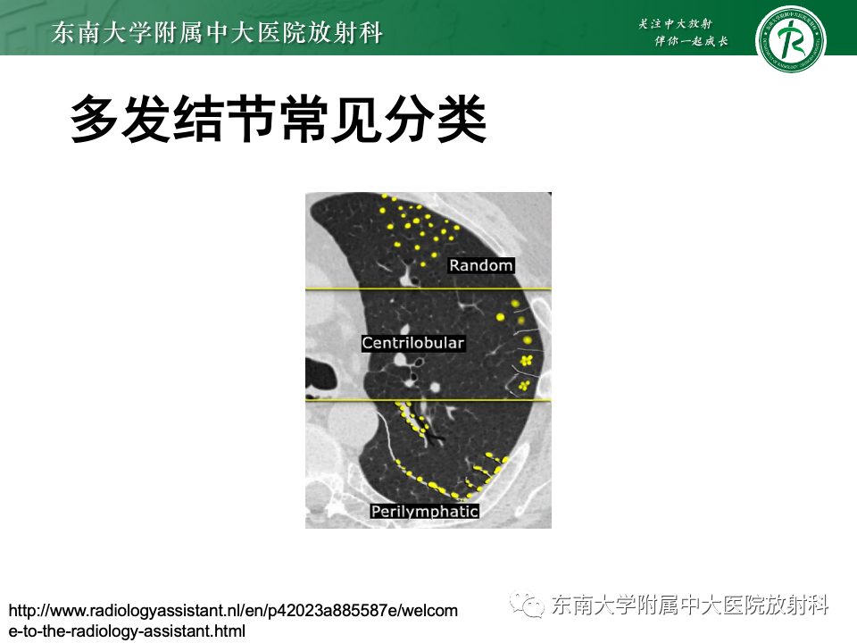 影像PPT - 【PPT】肺淋巴管周围结节-13