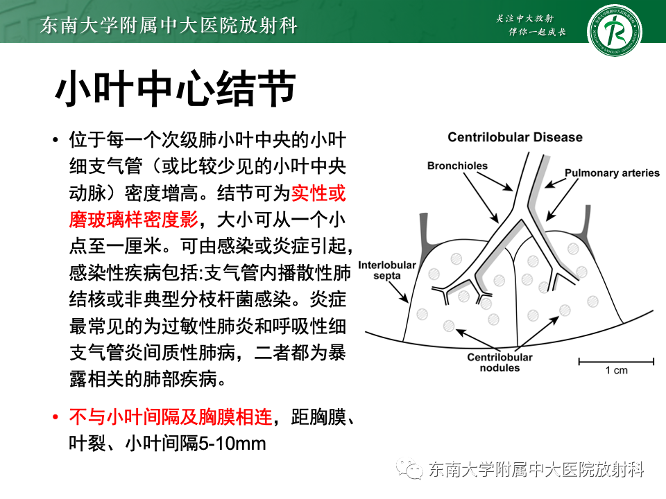 影像PPT - 【PPT】肺淋巴管周围结节-15