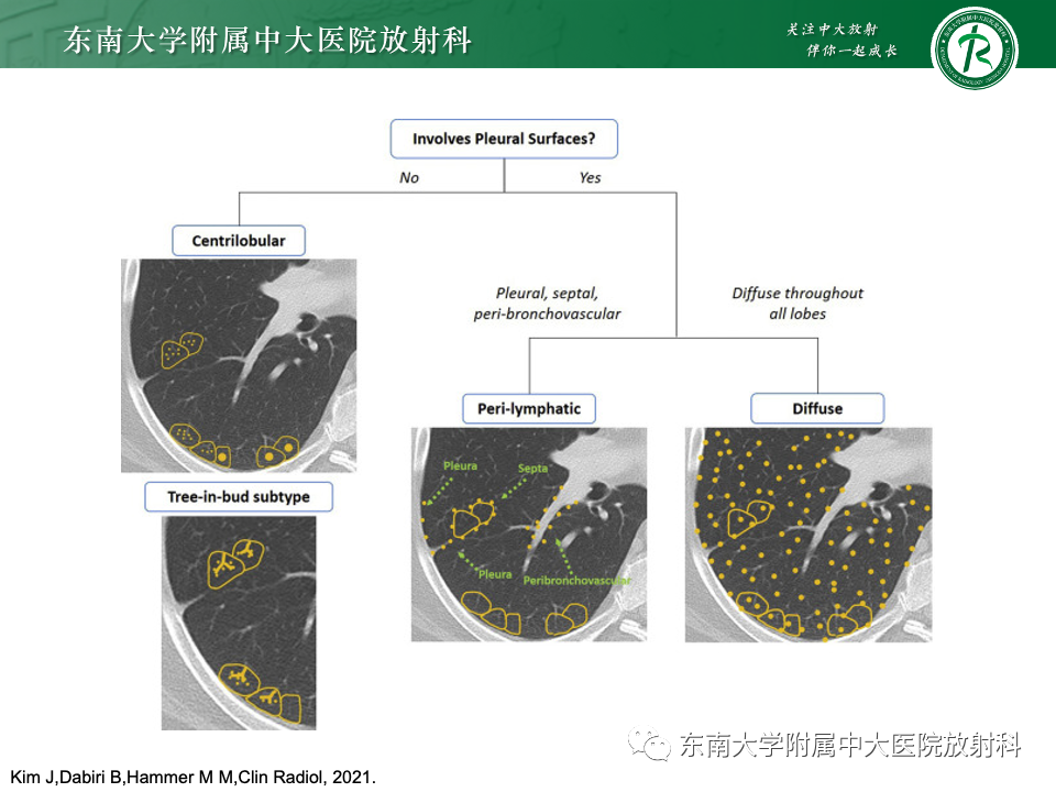 影像PPT - 【PPT】肺淋巴管周围结节-14