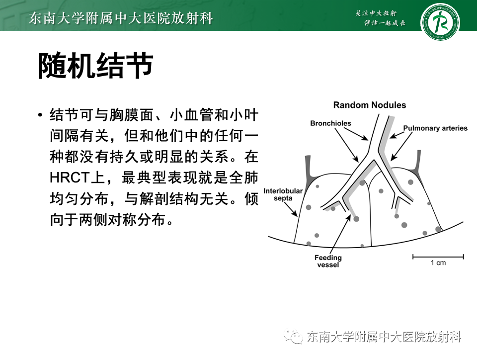 影像PPT - 【PPT】肺淋巴管周围结节-17