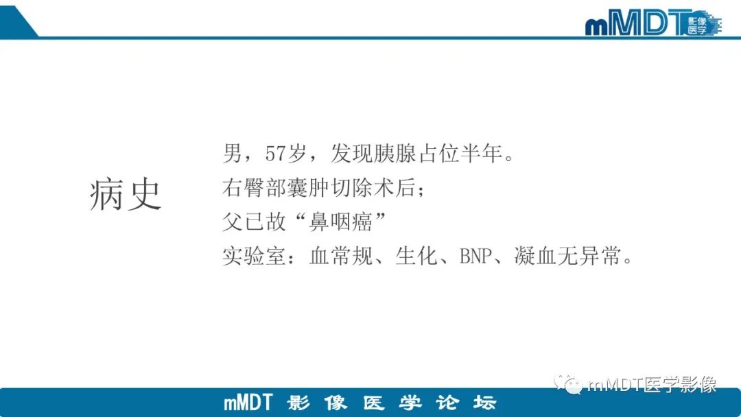 影像PPT - 【PPT】胰尾部副脾病例赏析-2 影像PPT - 【PPT】胰尾部副脾病例赏析-2