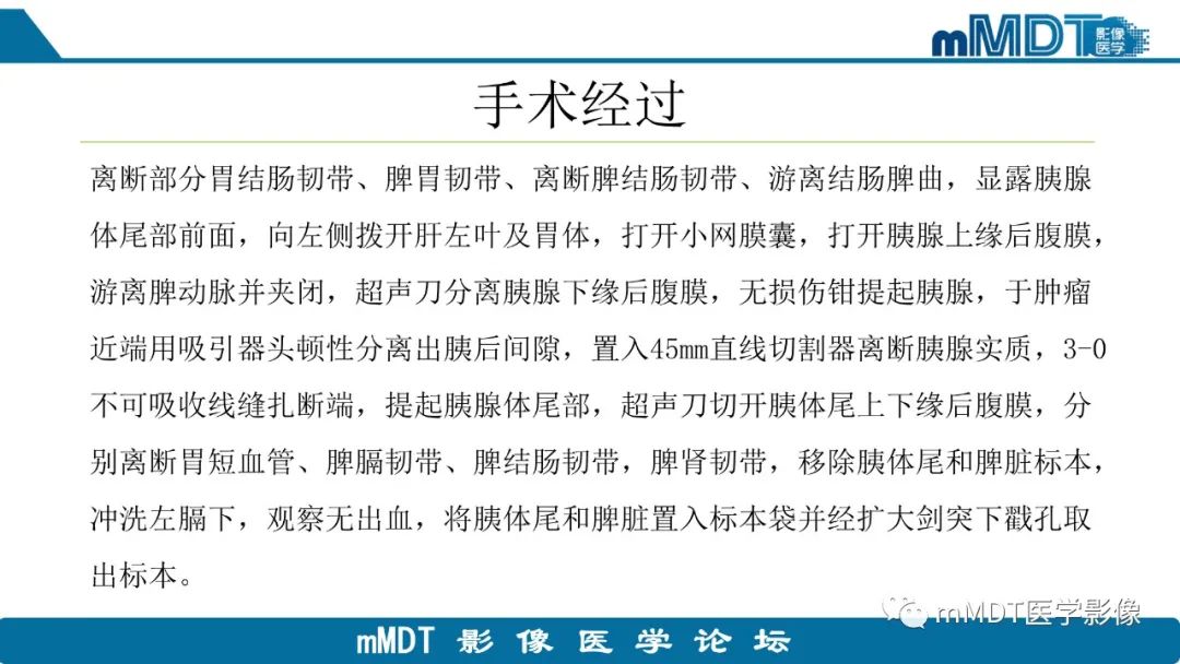 影像PPT - 【PPT】胰尾部副脾病例赏析-6 影像PPT - 【PPT】胰尾部副脾病例赏析-6