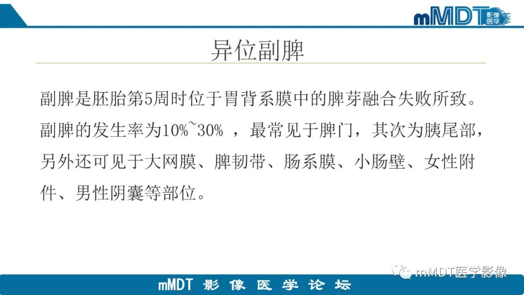 影像PPT - 【PPT】胰尾部副脾病例赏析-8 影像PPT - 【PPT】胰尾部副脾病例赏析-8