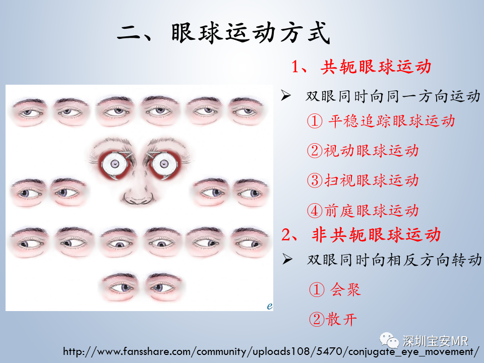 影像PPT - 【PPT】眼球运动障碍影像诊断-3