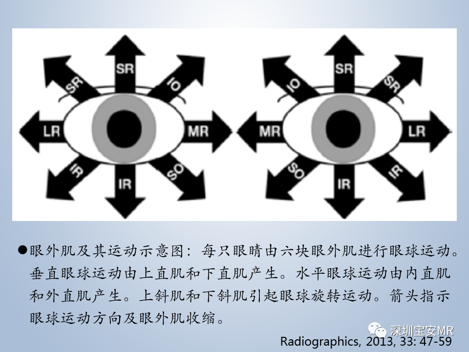 影像PPT - 【PPT】眼球运动障碍影像诊断-5