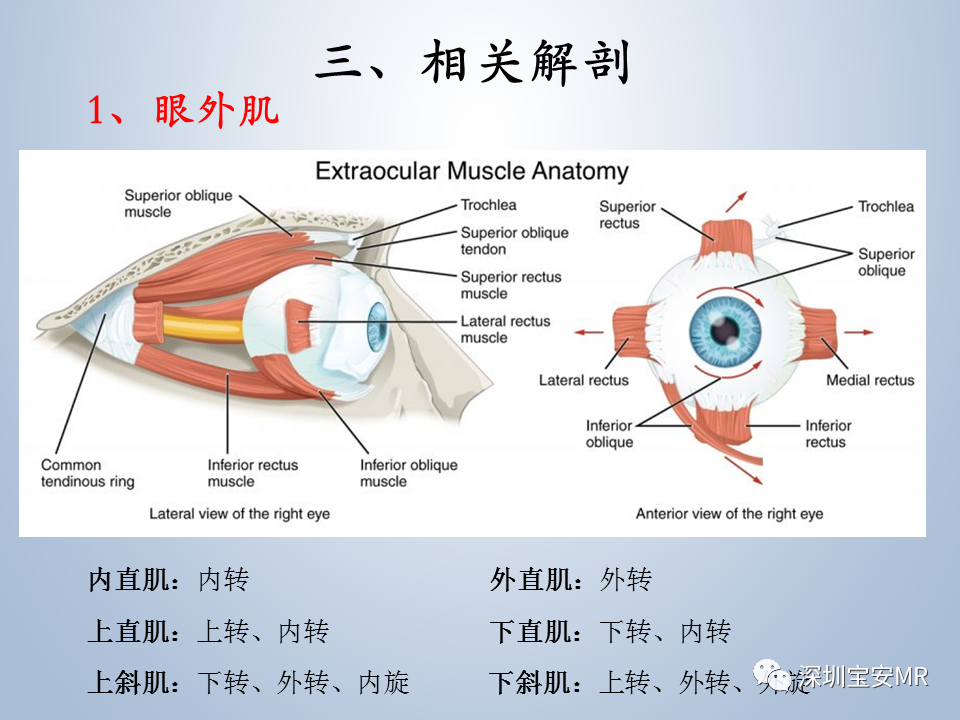 影像PPT - 【PPT】眼球运动障碍影像诊断-4