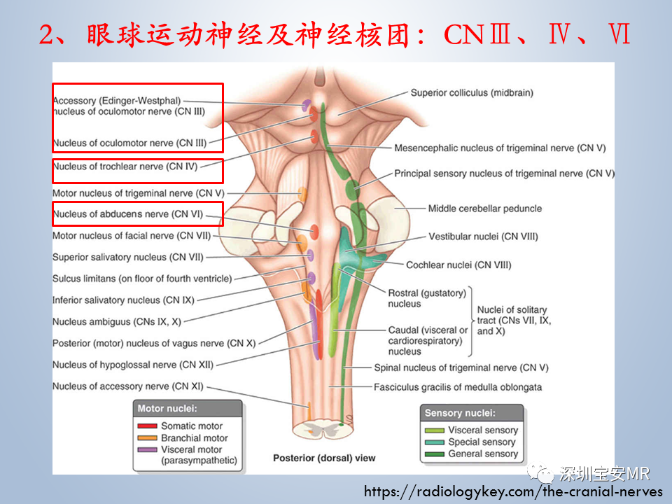 影像PPT - 【PPT】眼球运动障碍影像诊断-6