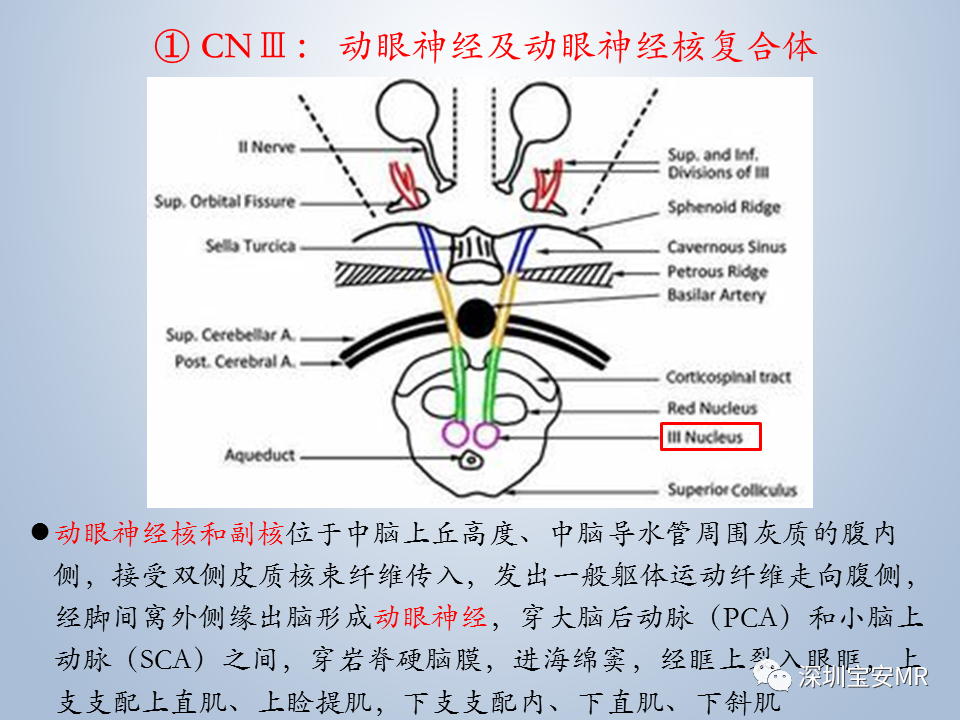 影像PPT - 【PPT】眼球运动障碍影像诊断-7