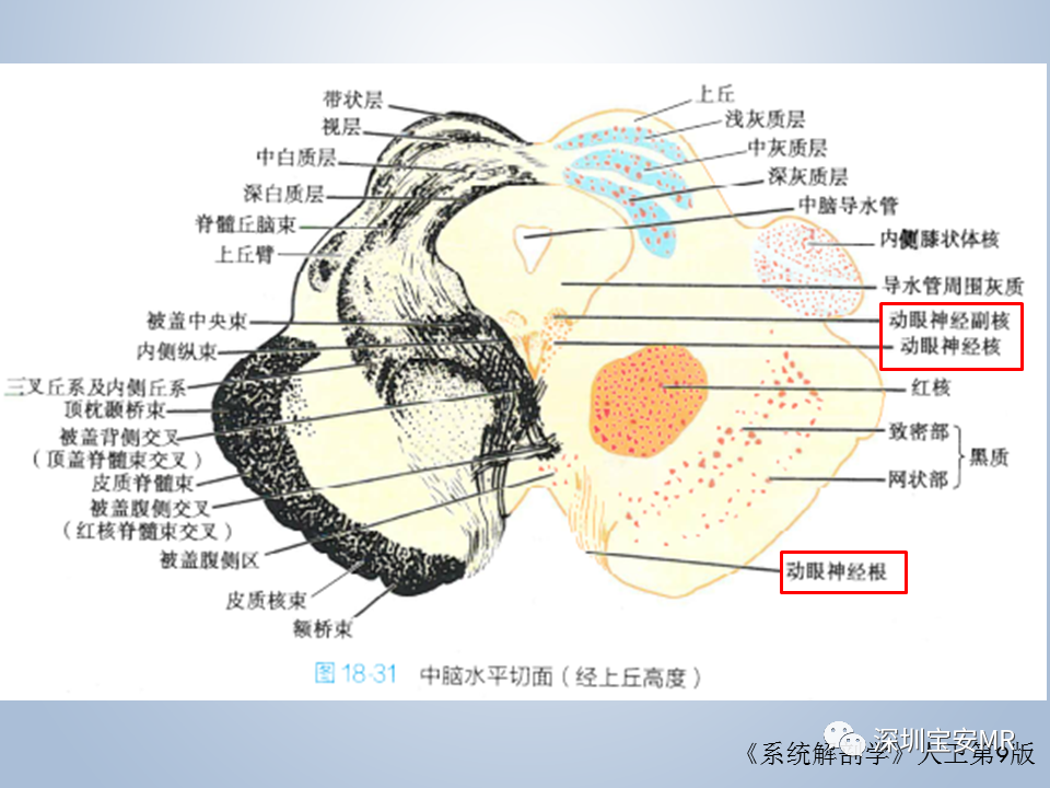 影像PPT - 【PPT】眼球运动障碍影像诊断-9