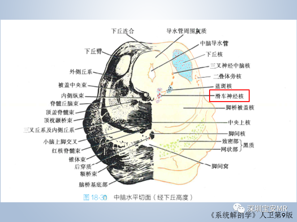 影像PPT - 【PPT】眼球运动障碍影像诊断-12