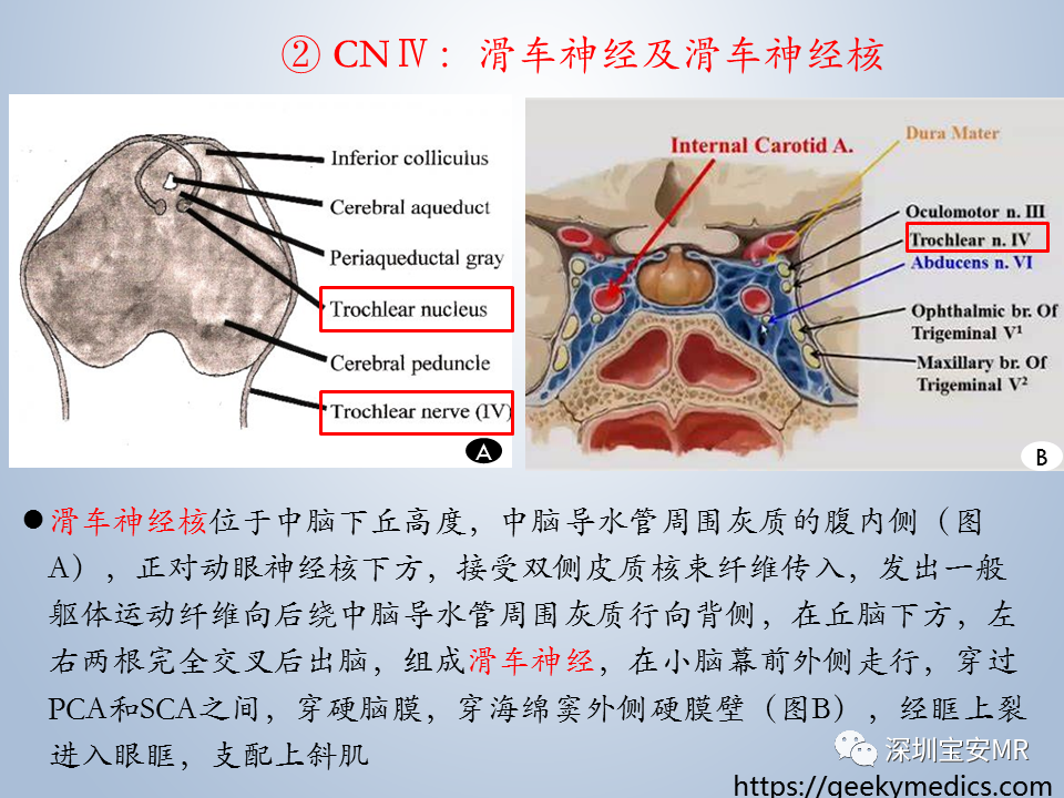 影像PPT - 【PPT】眼球运动障碍影像诊断-11
