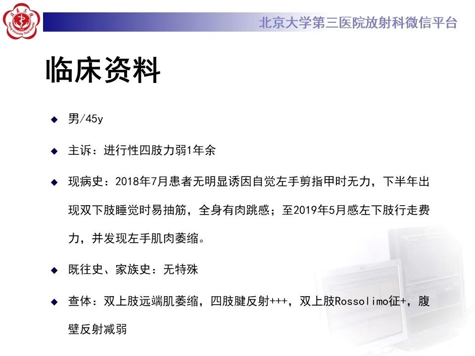 影像PPT - 【PPT】肌萎缩侧索硬化的影像-2