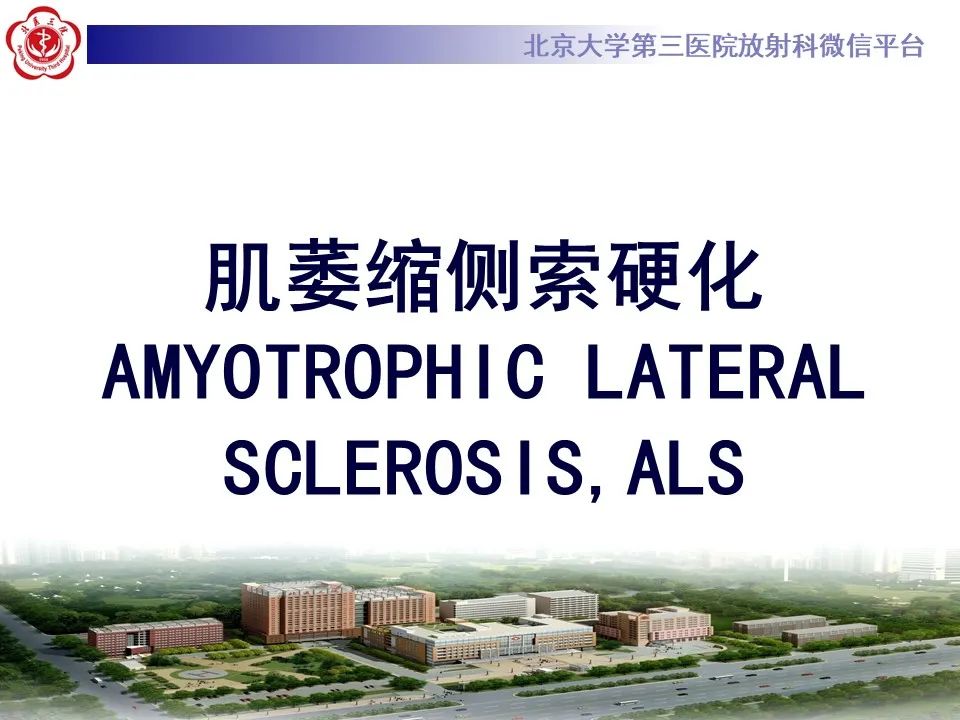 影像PPT - 【PPT】肌萎缩侧索硬化的影像-6