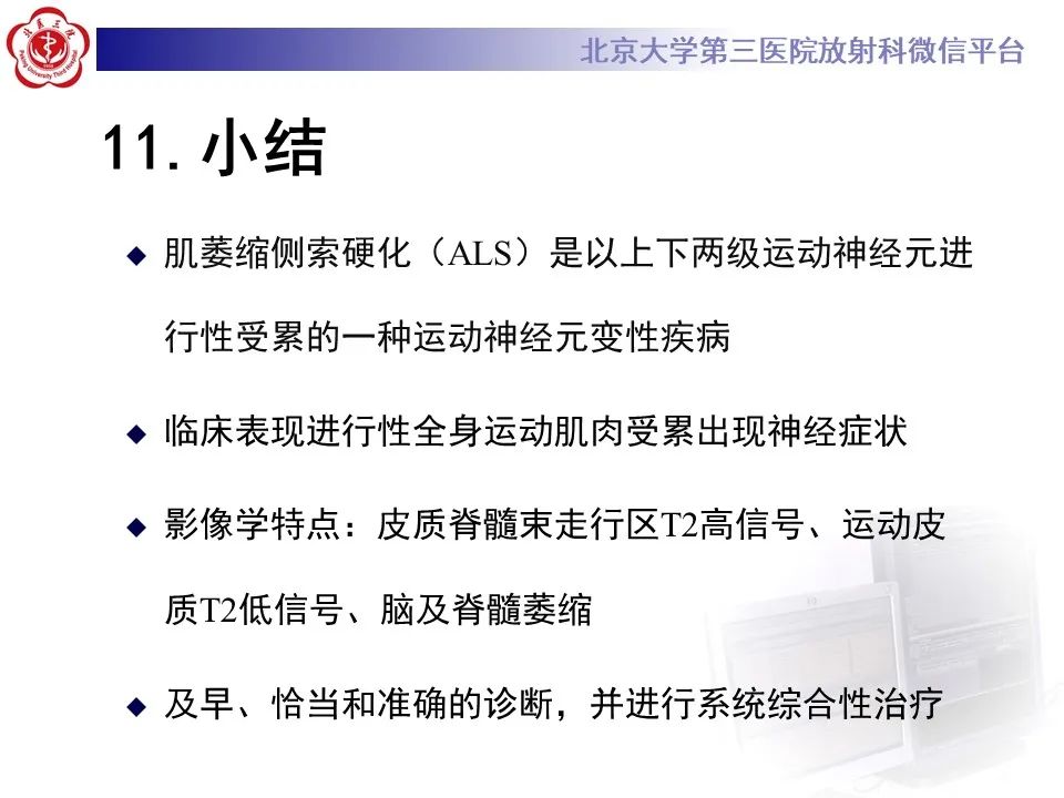 影像PPT - 【PPT】肌萎缩侧索硬化的影像-31