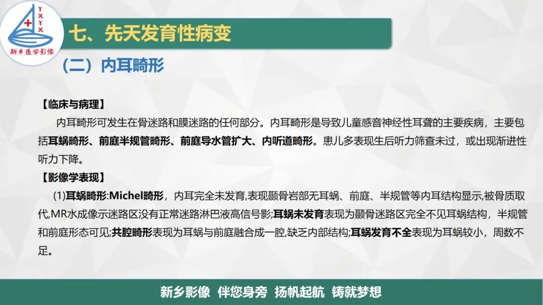 影像PPT - 【PPT】医学影像诊断学教材解读—耳部疾病2-18