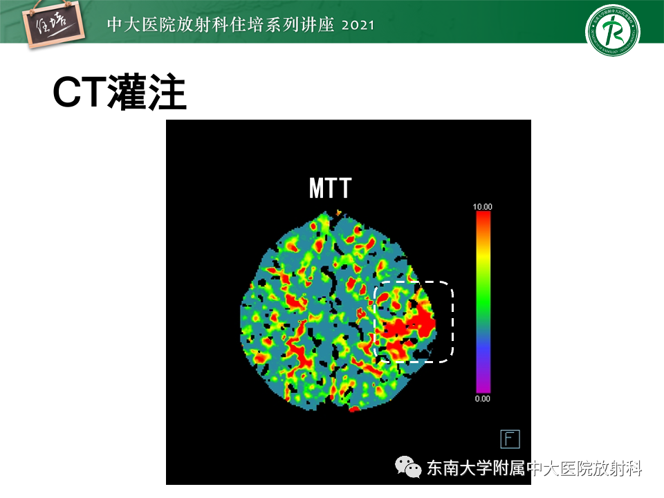 影像PPT - 【PPT】静脉性脑梗死的诊断思路-15