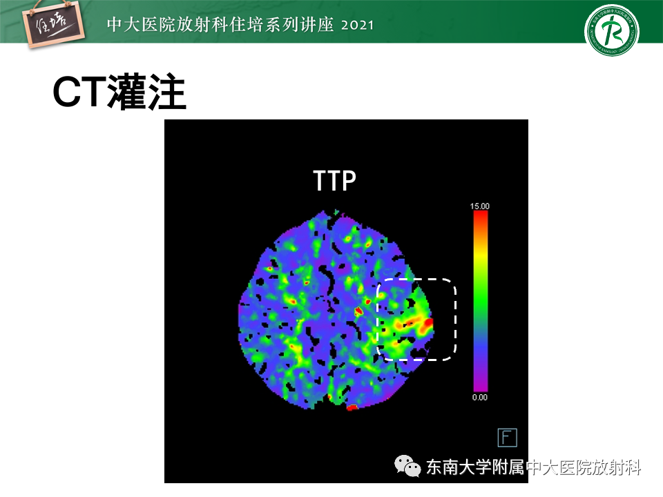 影像PPT - 【PPT】静脉性脑梗死的诊断思路-17