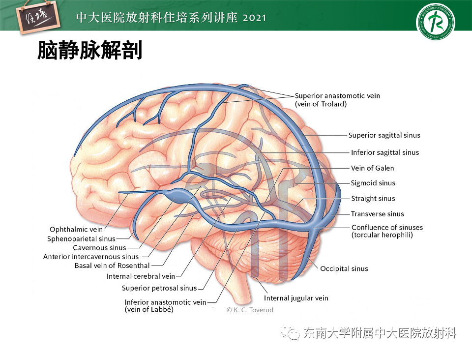 影像PPT - 【PPT】静脉性脑梗死的诊断思路-25