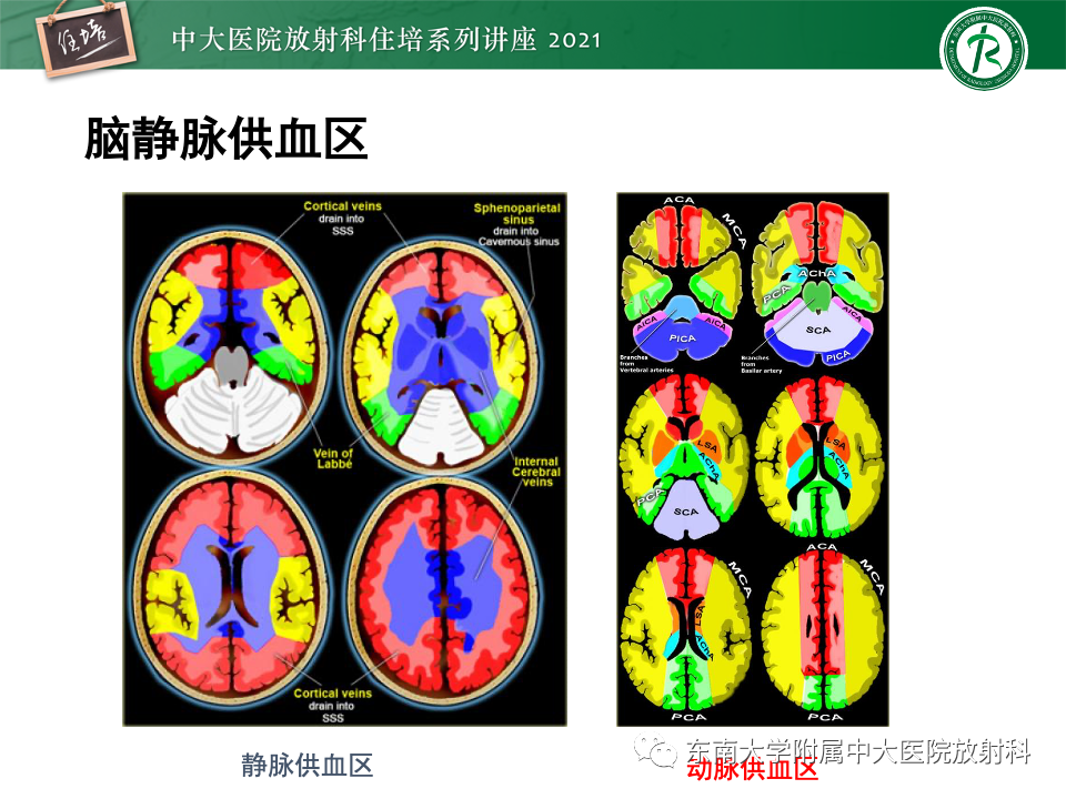 影像PPT - 【PPT】静脉性脑梗死的诊断思路-26