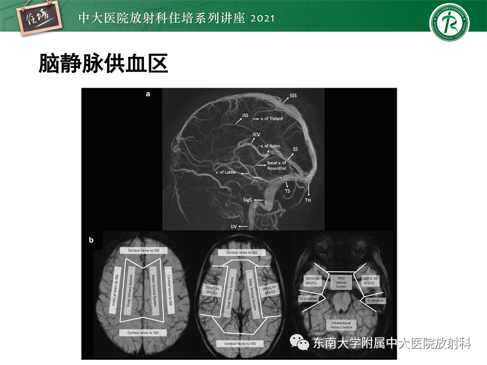 影像PPT - 【PPT】静脉性脑梗死的诊断思路-27