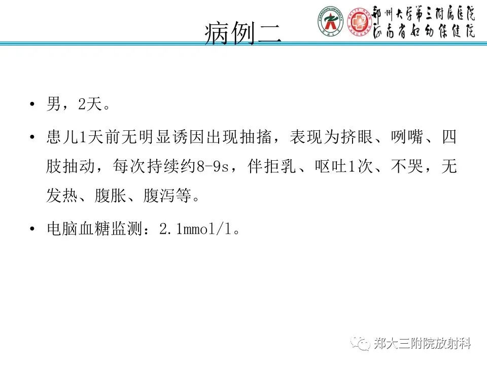 影像PPT - 【PPT】新生儿低血糖脑病-14