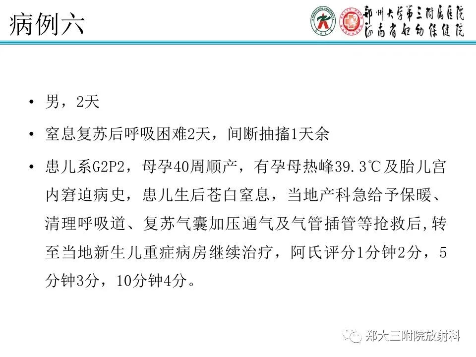 影像PPT - 【PPT】新生儿低血糖脑病-22