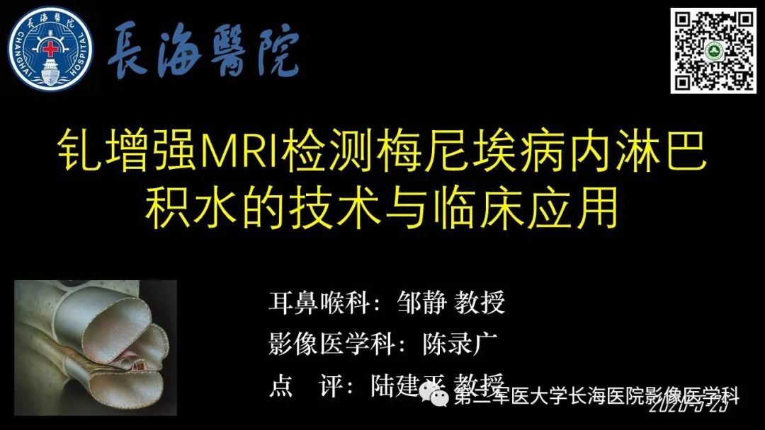 影像PPT - 【PPT】钆增强MRI检测梅尼埃病内淋巴积水的技术与临床应用-1
