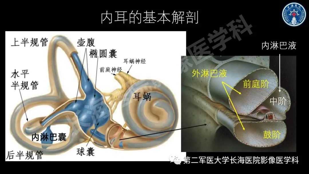 影像PPT - 【PPT】钆增强MRI检测梅尼埃病内淋巴积水的技术与临床应用-3