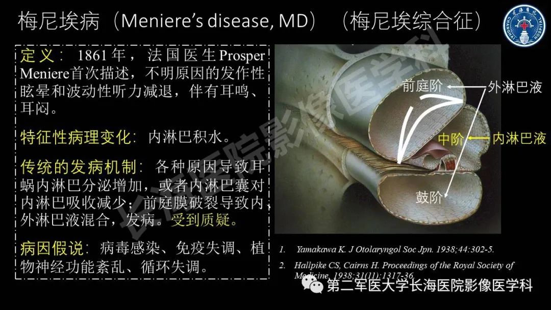 影像PPT - 【PPT】钆增强MRI检测梅尼埃病内淋巴积水的技术与临床应用-4