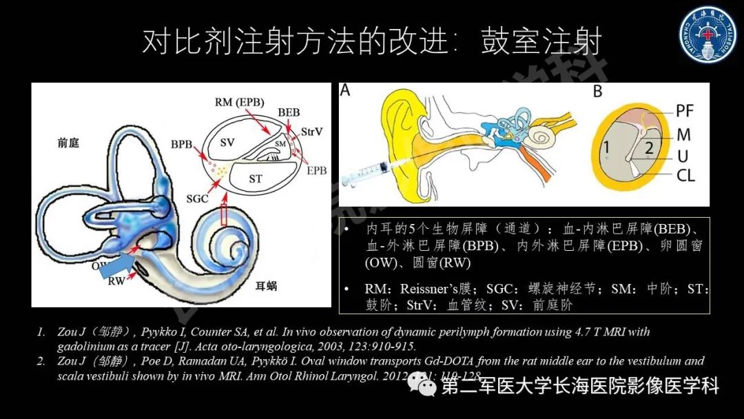 影像PPT - 【PPT】钆增强MRI检测梅尼埃病内淋巴积水的技术与临床应用-11