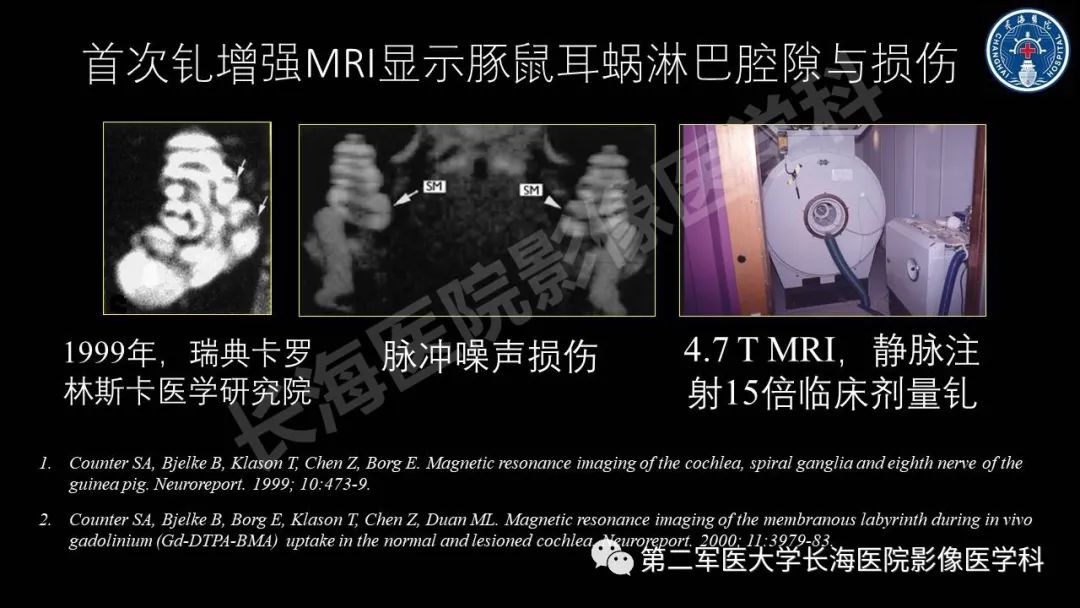 影像PPT - 【PPT】钆增强MRI检测梅尼埃病内淋巴积水的技术与临床应用-9