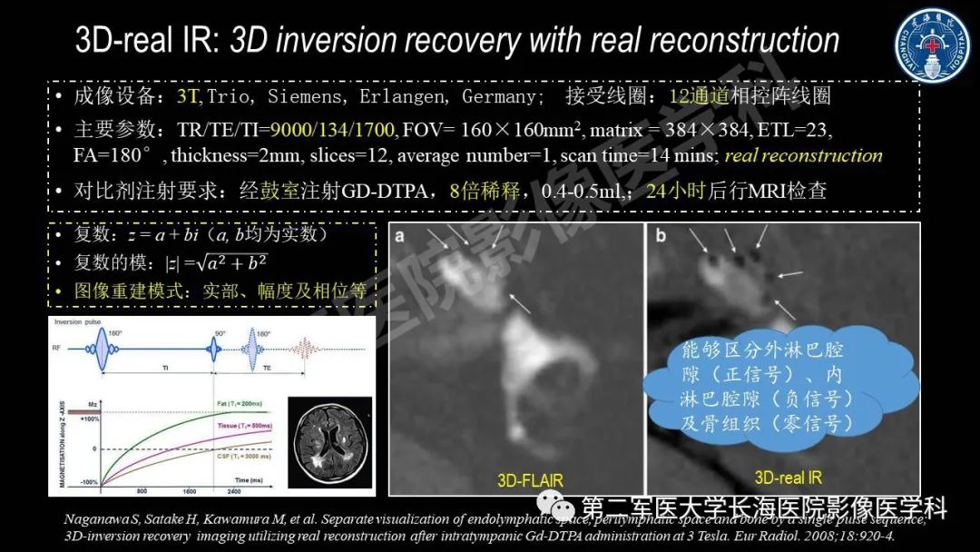 影像PPT - 【PPT】钆增强MRI检测梅尼埃病内淋巴积水的技术与临床应用-19