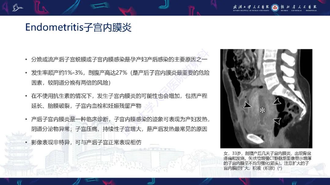 影像PPT - 【PPT】产后并发症影像诊断-8