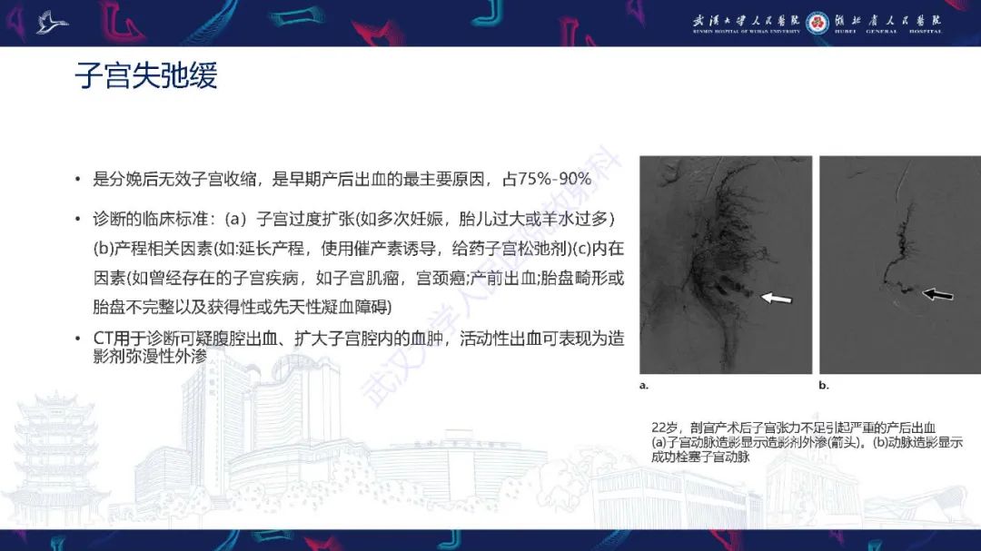 影像PPT - 【PPT】产后并发症影像诊断-19