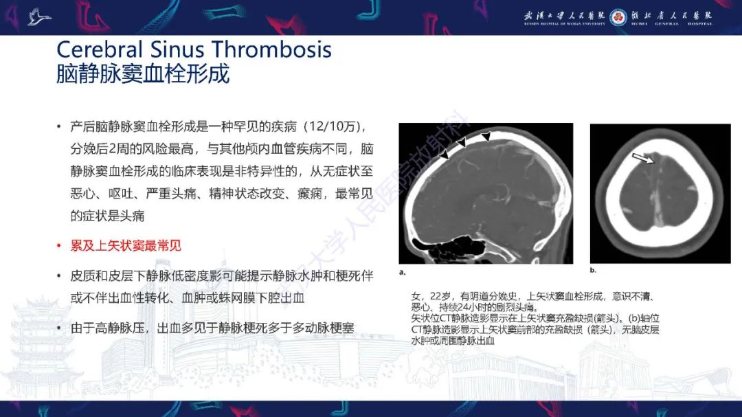 影像PPT - 【PPT】产后并发症影像诊断-16