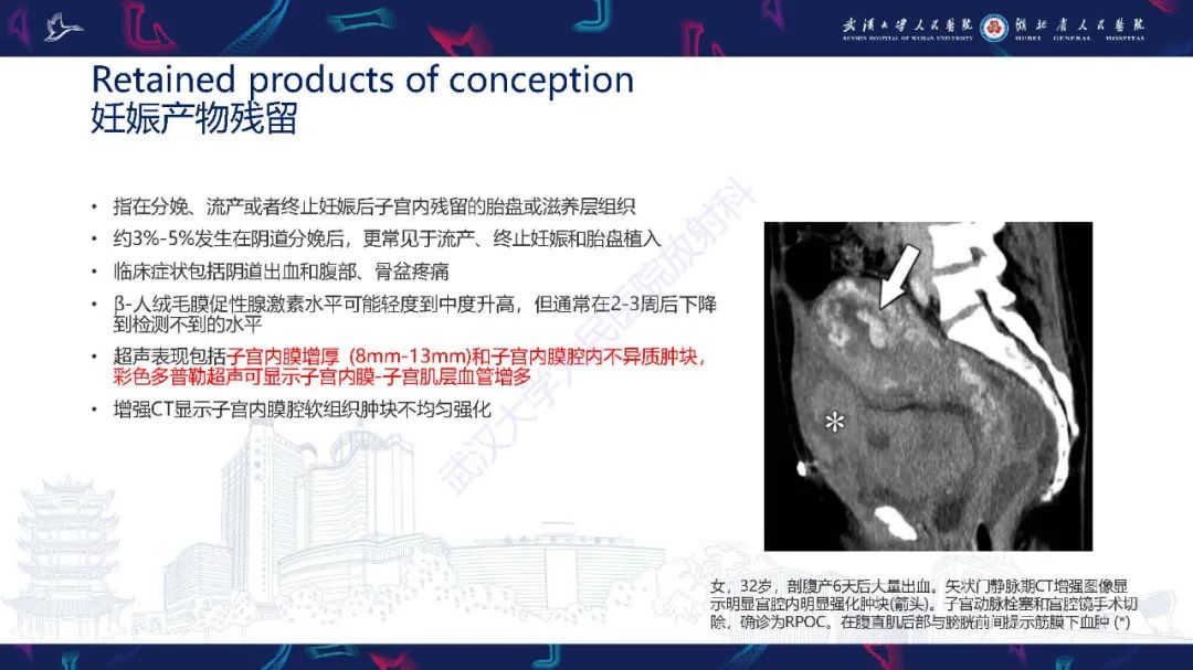 影像PPT - 【PPT】产后并发症影像诊断-24