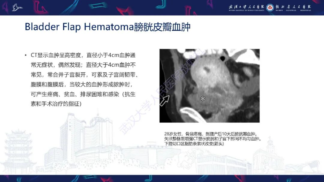 影像PPT - 【PPT】产后并发症影像诊断-29