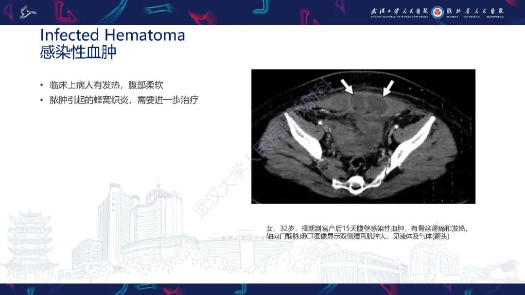 影像PPT - 【PPT】产后并发症影像诊断-32