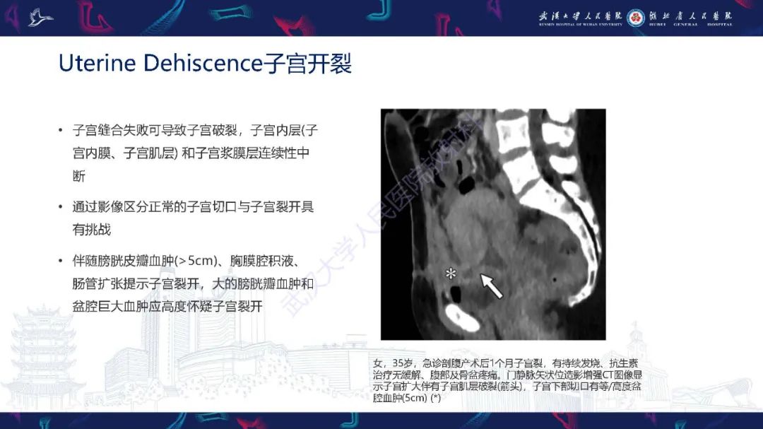 影像PPT - 【PPT】产后并发症影像诊断-33