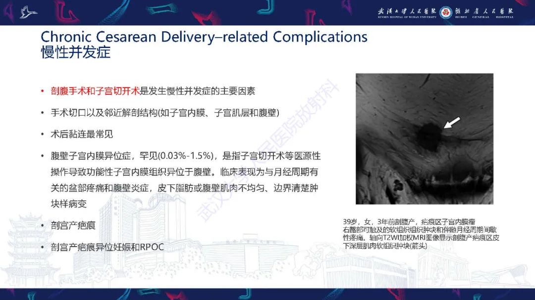 影像PPT - 【PPT】产后并发症影像诊断-36