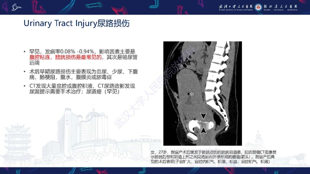 影像PPT - 【PPT】产后并发症影像诊断-35